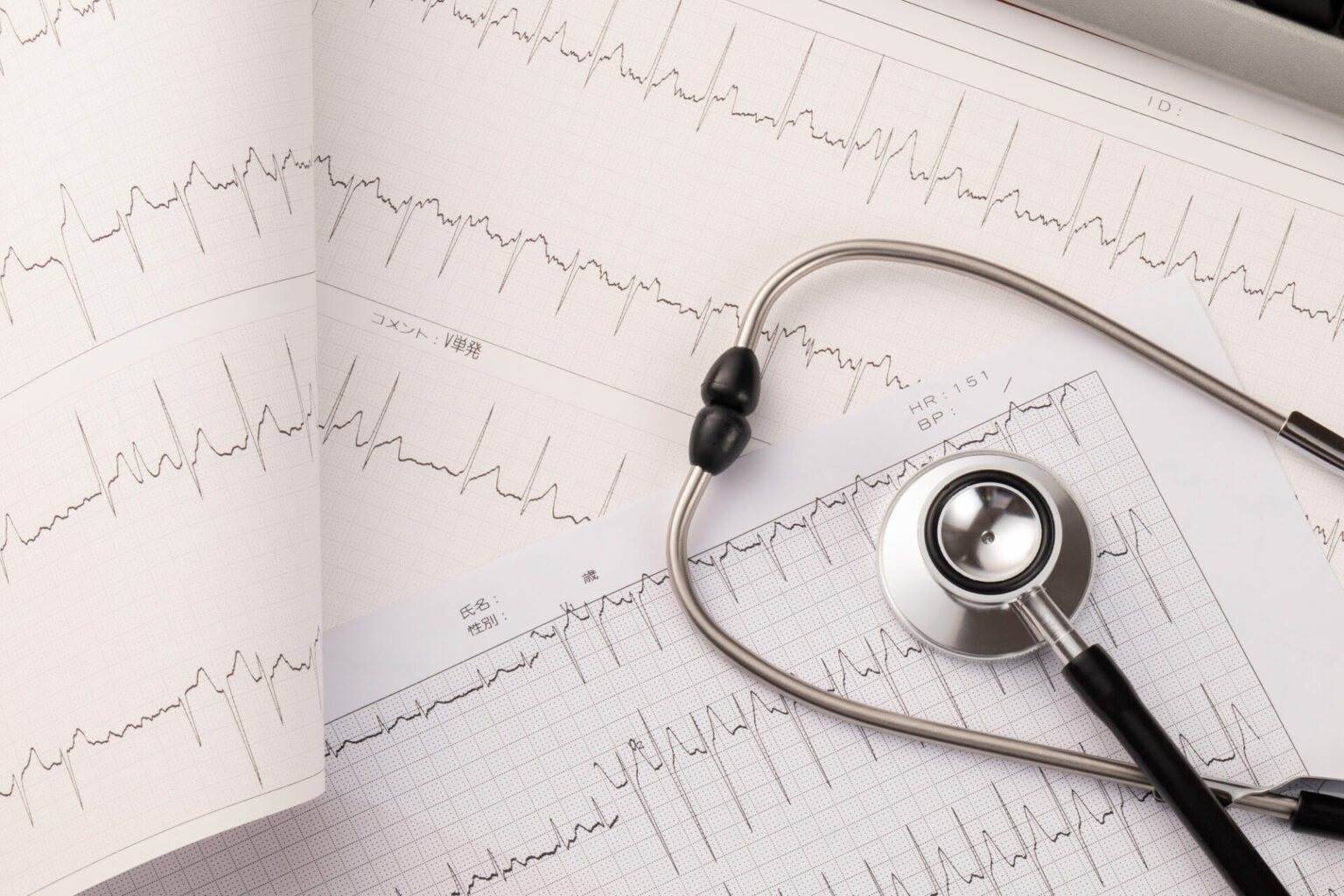 マルファン症候群とは: この稀な病気について学びましょう